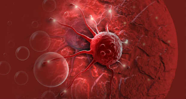 Új tesztet fejlesztettek a hasnyálmirigyrák korai felfedezésére