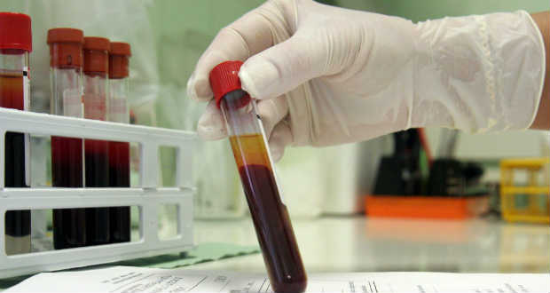 Beköltözött Európába a hepatitis-A