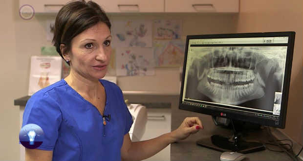 Sok gondot okozhat a rossz pozíciójú bölcsességfog