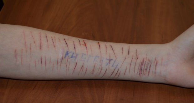 Kárpátalját is elérték az öngyilkosságra biztató internetes felkeresések