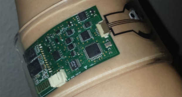 Izzadságelemző-karkötő segíti a betegségek felismerését