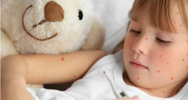 Növekszik a kanyarós megbetegedések száma Kárpátalján