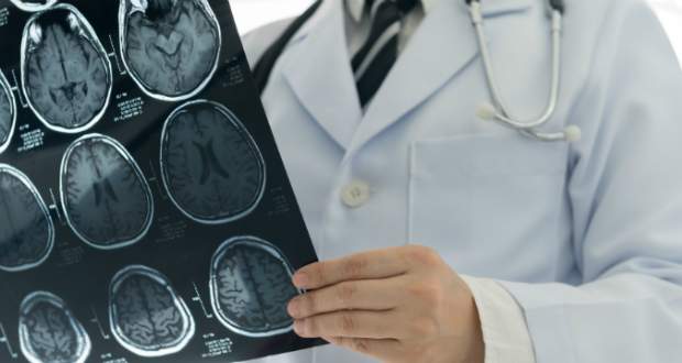 Óriási áttörés a szélütés elleni küzdelemben