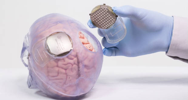 Gondolatolvasó eszközt fejlesztettek ki Oroszországban