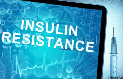 Öt tévhit az inzulinrezisztenciáról