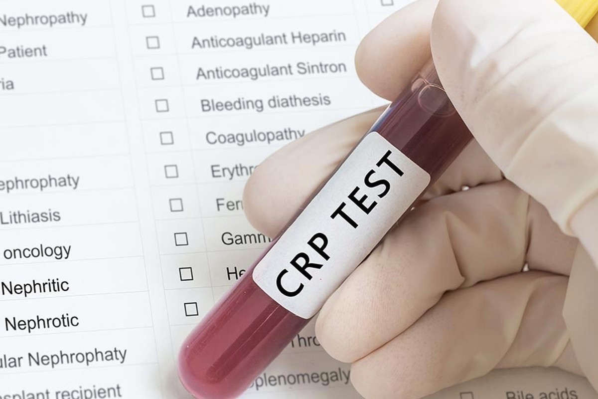 CRP teszt