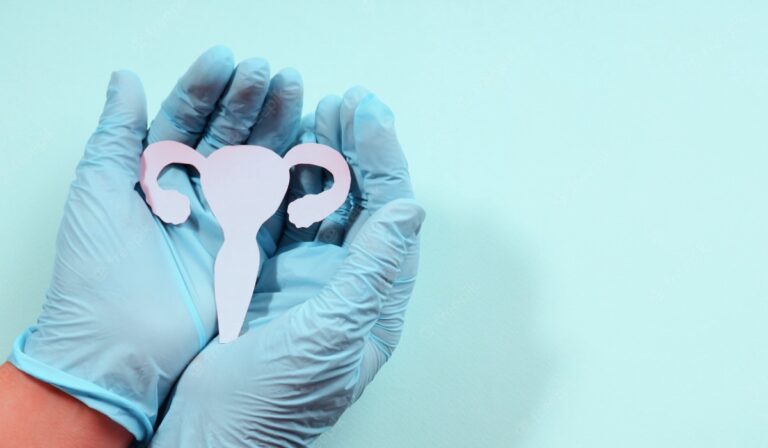 még PCOS