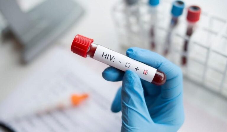 Veszélyes tévhitek a HIV-ről és az AIDS-ről