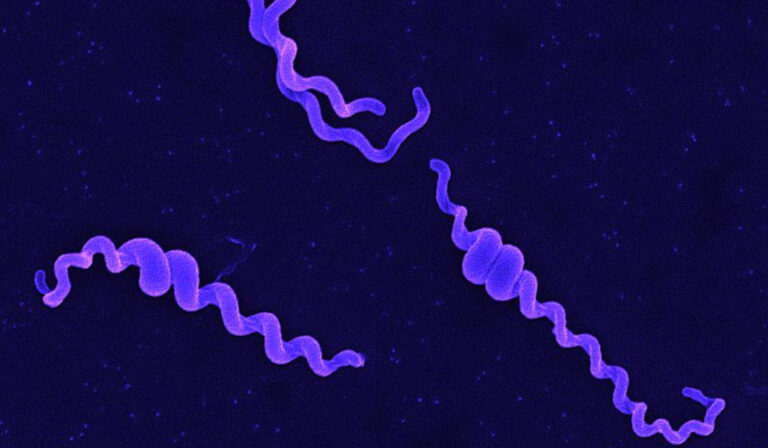 Leptospirózis Kárpátalján: emelkedett a fertőzöttek száma