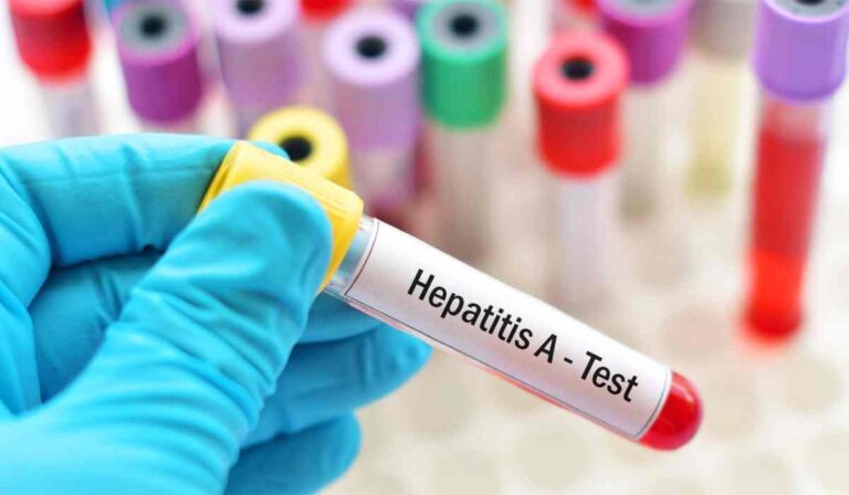 Hepatitis A-járvány terjed a Huszti járásban