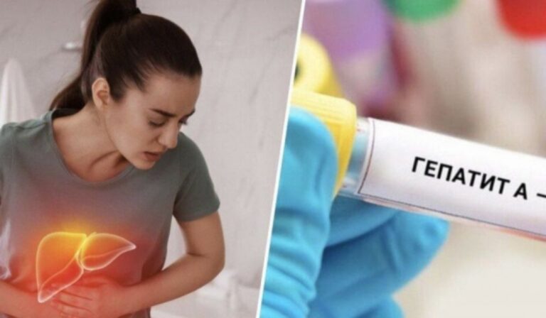 Több mint 10 személy került kórházba hepatitis A-val Kárpátalján