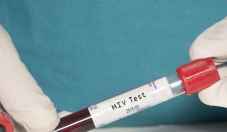 A HIV és hepatitis szűrésének nemzetközi hete Ukrajnában