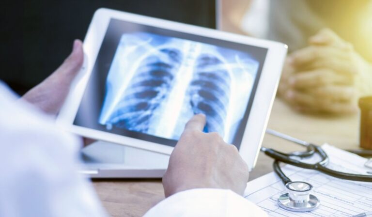 Nőtt a tuberkulózisban szenvedő gyerekek száma Kárpátalján