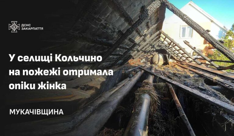 Égési sérüléseket szerzett egy kölcsényi nő