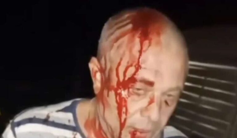 Brutálisan megtámadtak egy ukrán családot Lengyelországban
