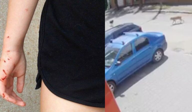 Tizenegyéves gyermeket harapott meg egy kutya Ungváron