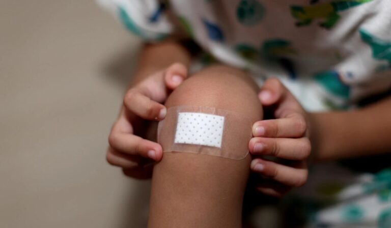 Sebkezelés otthon: ezeket a lépéseket kövesd 