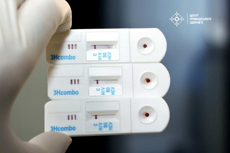Elindult az európai HIV- és hepatitisztesztelési hét: életet menthet, ha tudják a státuszukat